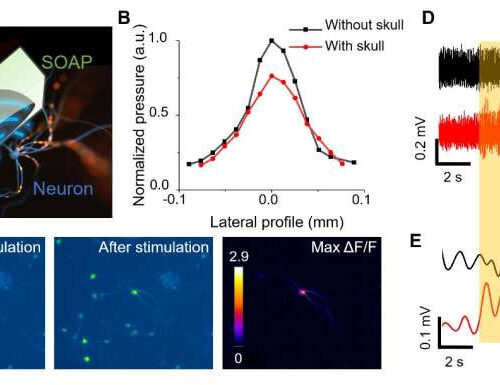 Optically-generated focused ultrasound for noninvasive brain stimulation with ultrahigh precision