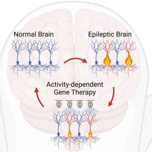 Gene therapy targeting overactive brain cells could treat neurological disorders