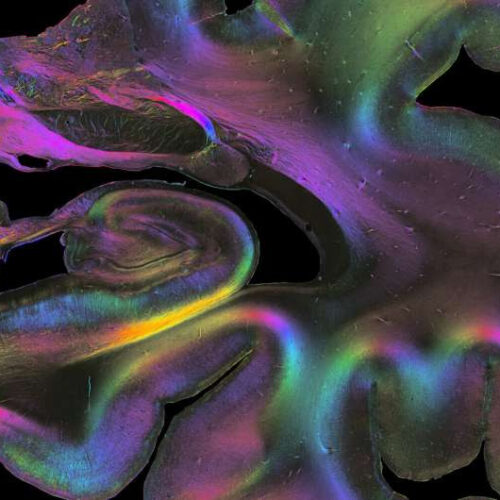 A combination of micro and macro methods sheds new light on how different brain regions are connected