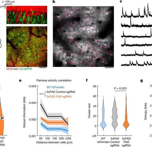 Swelling along brain’s axons may be true culprit in Alzheimer’s disease