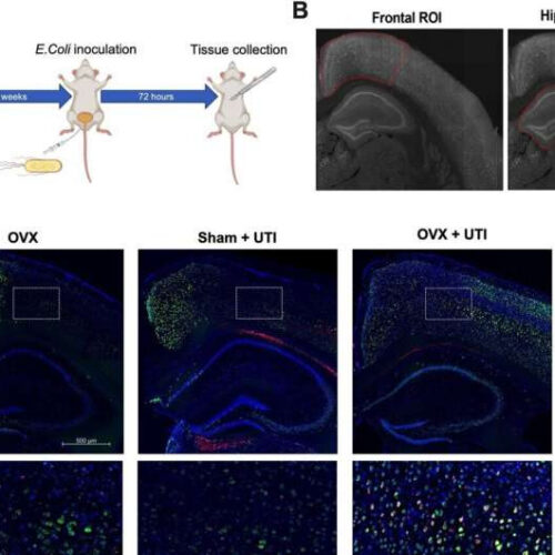 Estrogen may offer protection against delirium