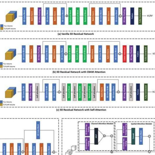 AI better than human eye at predicting brain metastasis outcomes, find researchers