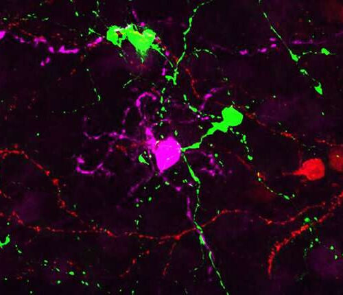 Ganglion cells created in mice in bid to fix diseased eyes