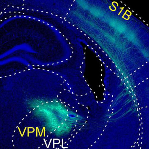 How touch dampens the brain’s response to painful stimuli