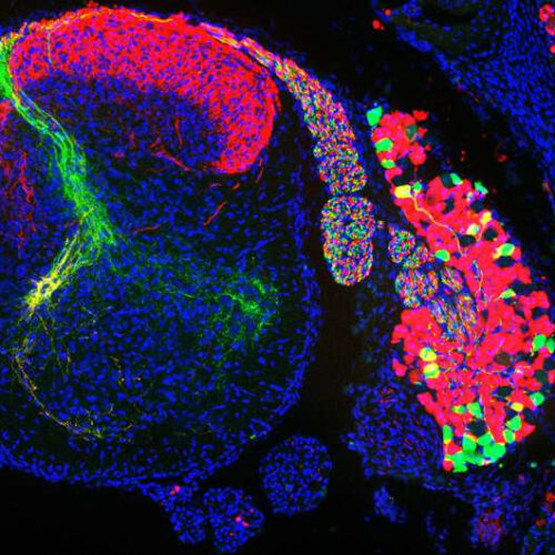 Describing the genes associated with the sixth sense