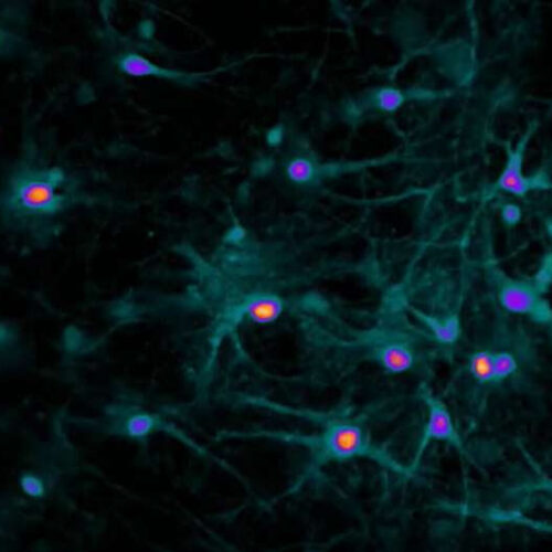 Scientists elucidate how chemogenetic technology highjacks neuronal activity