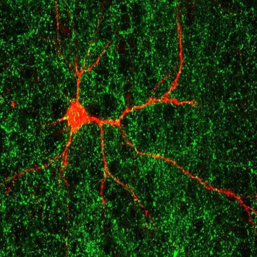 Autism-linked gene found to shape nerve connections