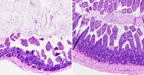 Scientists develop compound that reverses gut inflammation in mice