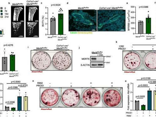 Enzyme inhibition promotes bone formation and curbs the development of bone metastases, study finds