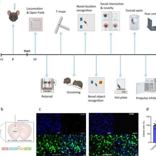 Researchers discover crucial role of brain’s striatum cilia in time perception