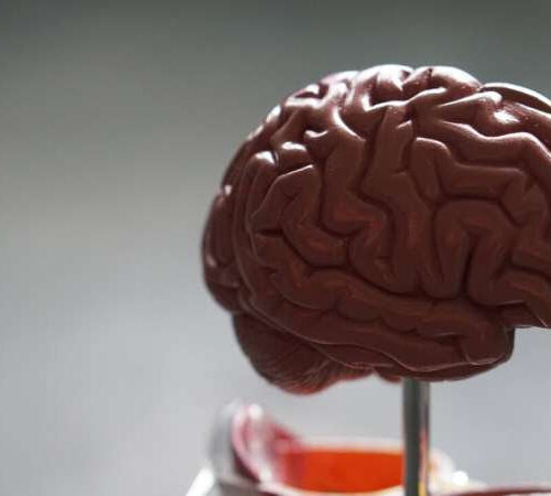 Researchers find that brains with more vitamin D function better