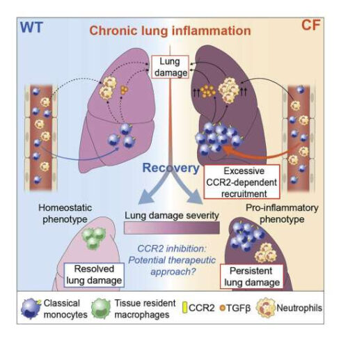 Driver of cystic fibrosis lung inflammation yields target for treatment