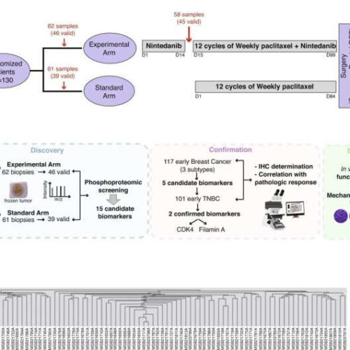 Researchers discover how to predict the efficacy of one of the most widely used drugs against breast cancer