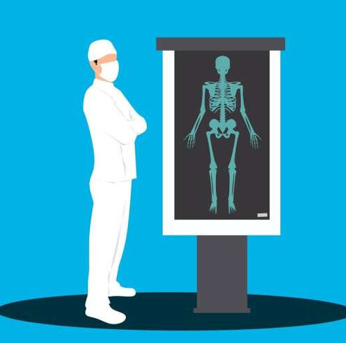 Whole body scan shows the complexity of the immunotherapy response