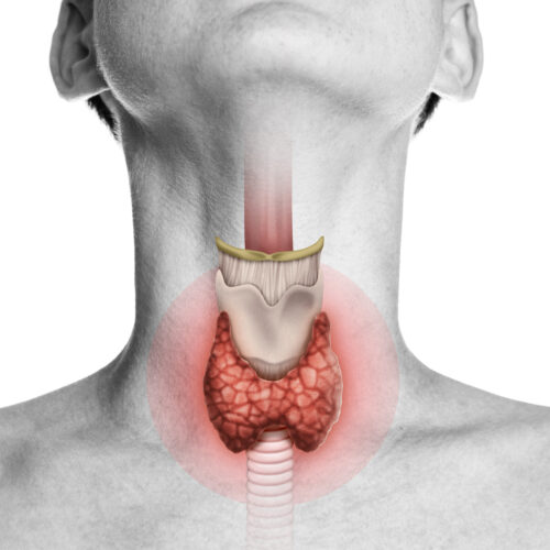 Thyroid Awareness