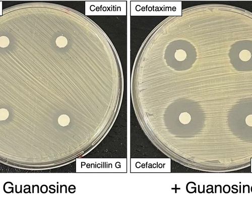 Scientists discover potential new method to treat superbug infections