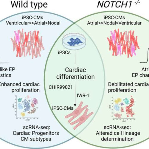 New insights into the role of the NOTCH1 gene in congenital heart defects