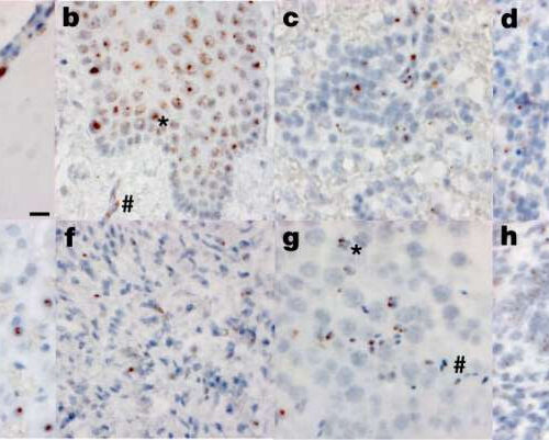 Autopsies show COVID-19 virus in brain, elsewhere in body