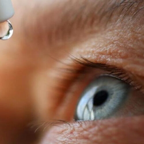 Dry Eye: Symptoms, Treatment, Prevention