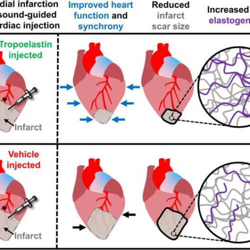 Scientists find way to heal scars left behind by heart attacks