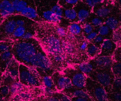 Stress-tolerant cells shown to drive tumor initiation in pancreatic cancer