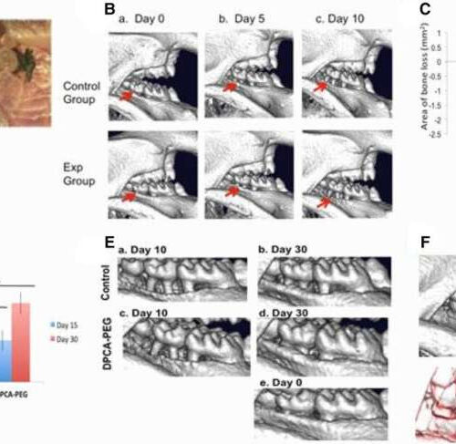 Regenerative drug restores bone in preclinical study