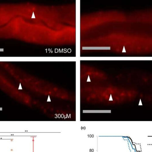 Hypertension drug could be repurposed to delay aging, study finds