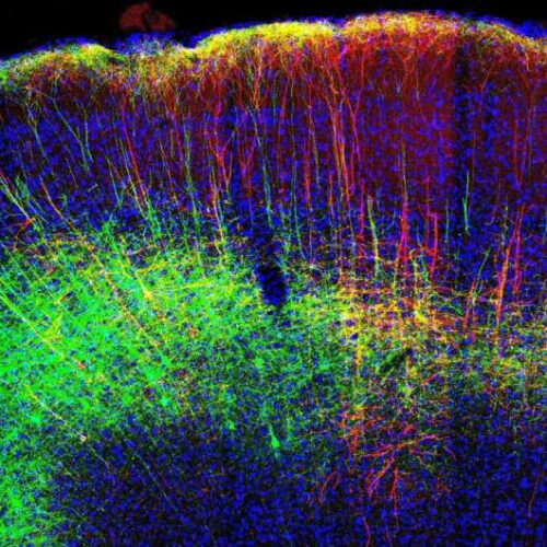 Researchers study pain-relieving neural mechanisms by activation of the motor cortex