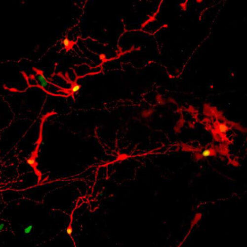 Lab-grown retinal eye cells make successful connections, open door for clinical trials to treat blindness