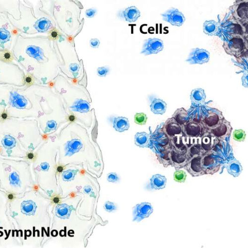 Tiny, implantable therapeutic sponge device helps kill cancer in mice