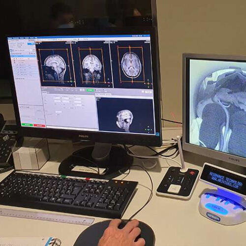 One-minute exposure to monochromatic light shown to modify neural connections