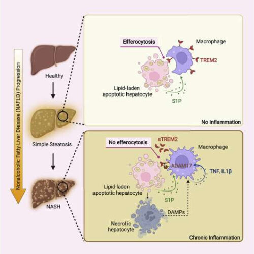 Immunologists uncover obesity-linked trigger to severe form of liver disease