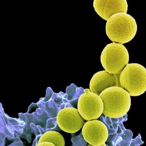 Probiotic markedly reduces S. Aureus colonization in phase 2 trial