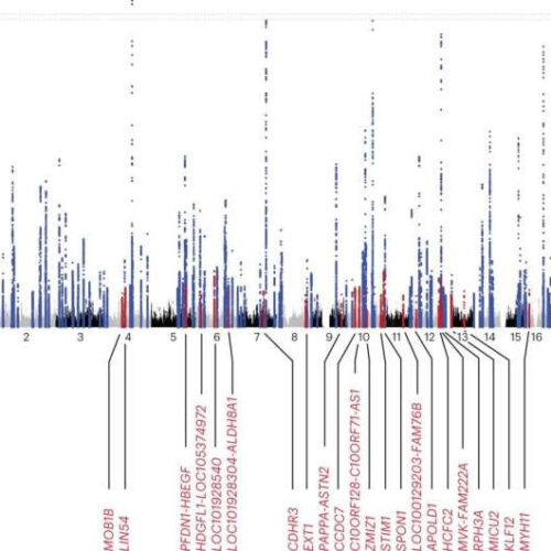 The best genetic predictors of heart arrhythmia and hidden comorbidity