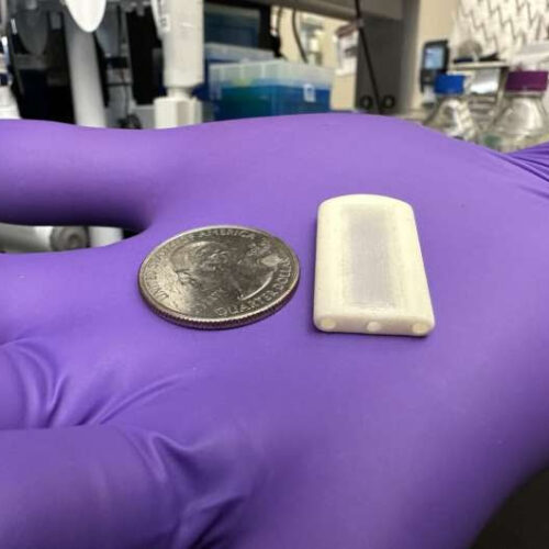 Wafer-thin device has potential to transform the field of islet cell transplantation