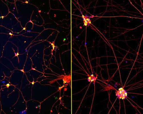 Mature ‘lab grown’ neurons hold promise for neurodegenerative disease