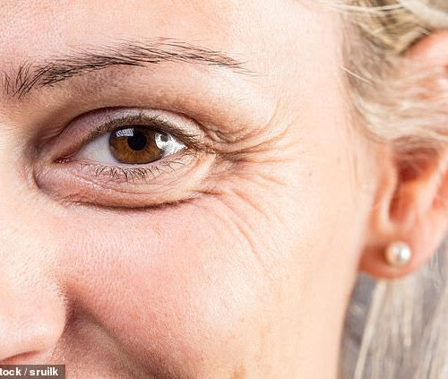 High-tech tiny ‘plug’ to soothe dry eyes could offer an alternative for patients who struggle with drops