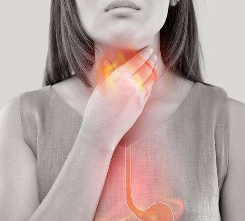 Expert explains why reflux disease isn’t ‘just’ heartburn