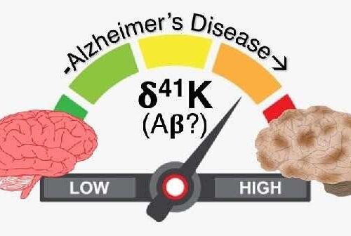 Researchers find accumulation of amyloid beta protein at sites of potassium depletion in the brain