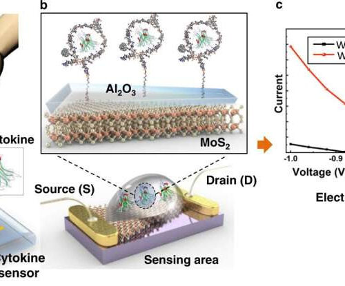 Scientists developing early Alzheimer’s disease detection sensor