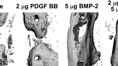 Combining two bone healing remedies can inhibit bone growth and regeneration