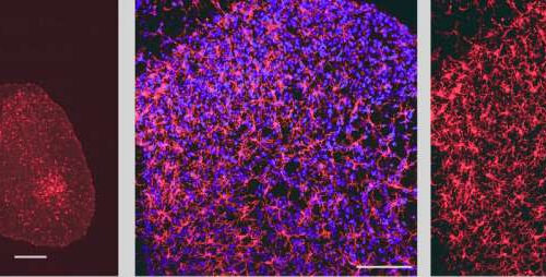 Calcium channels regulate neuroinflammation and neuropathic pain