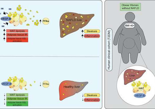 Study identifies an antibody candidate for treating serious liver disease