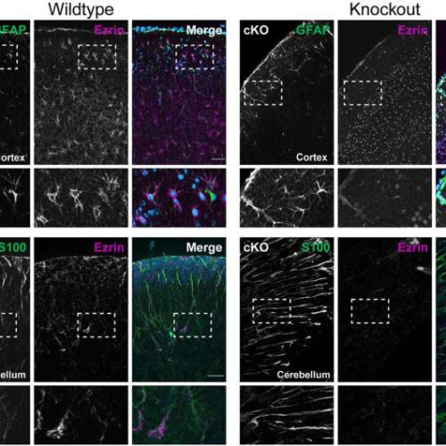 How the absence of a protein could help people better cope with the consequences of a stroke