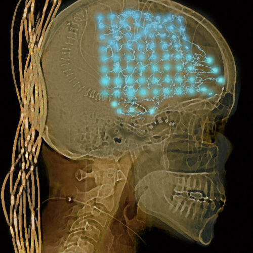 Neuroscientists listened in on people’s brains for a week. They found order and chaos