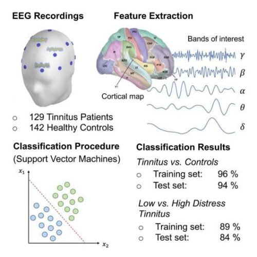 New EEG procedure accurately measures distress caused by tinnitus