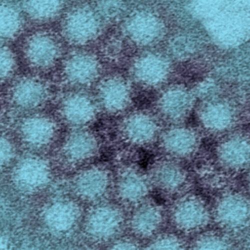 Norovirus is spiking across the United States – Often called “stomach flu,” it isn’t a flu at all, but it is very contagious