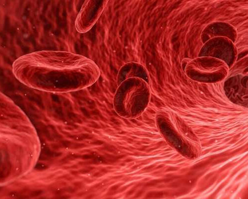 ‘Spleen-on-a-chip’ yields insight into sickle cell disease