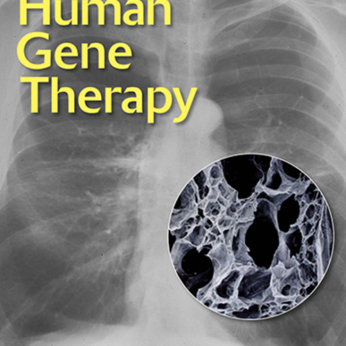 Second generation gene therapy for alpha 1-antitrypsin deficiency