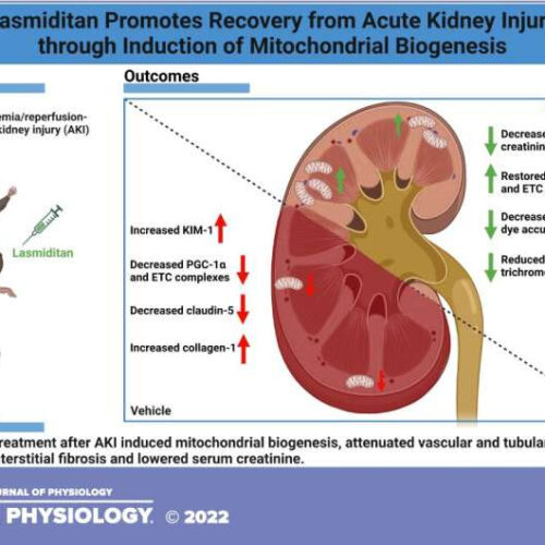 Migraine drug shows promise in treatment of acute kidney injury